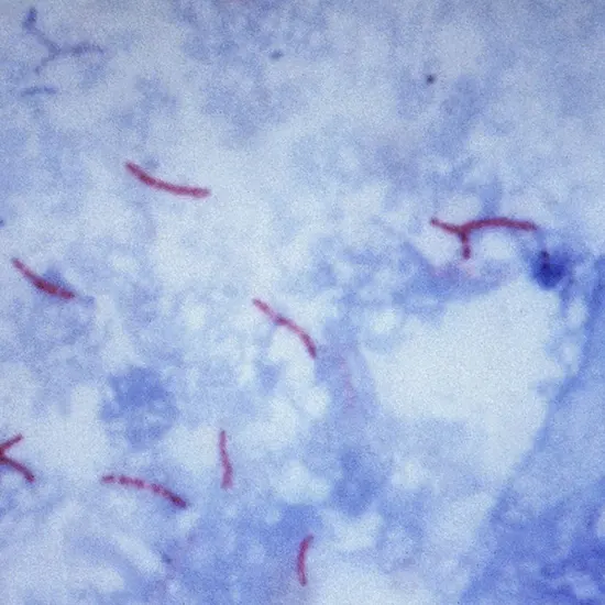 AFB Culture (Rapid) and Ziehl-Neelsen (ZN) Stain